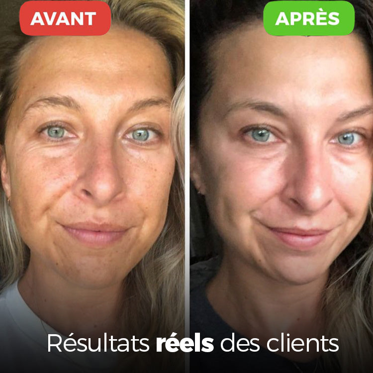 Aquapure - Améliore l'apparence de la peau